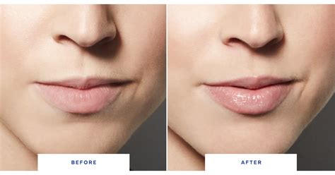 dior lip plumper before after